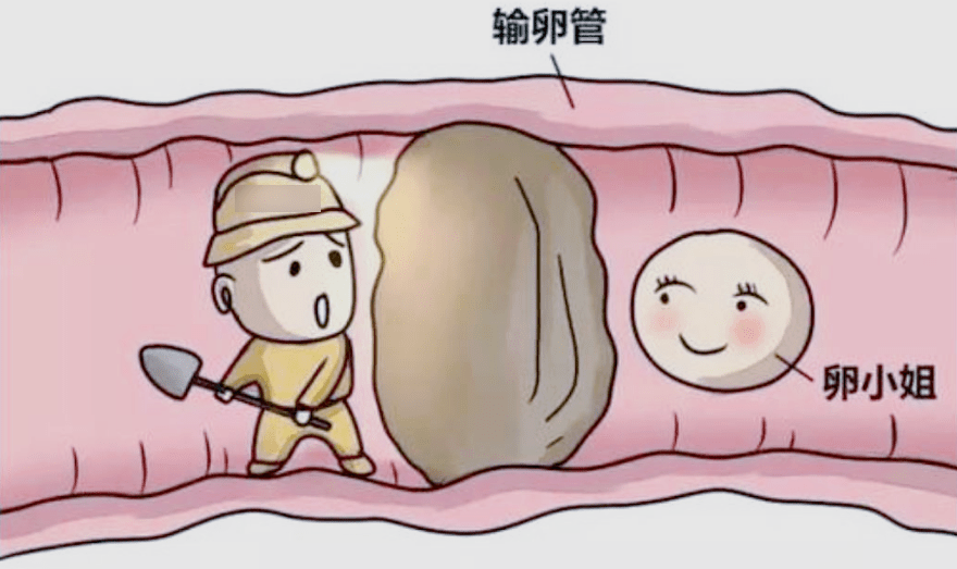 輸卵管堵塞為什么會引起疼痛癥狀?