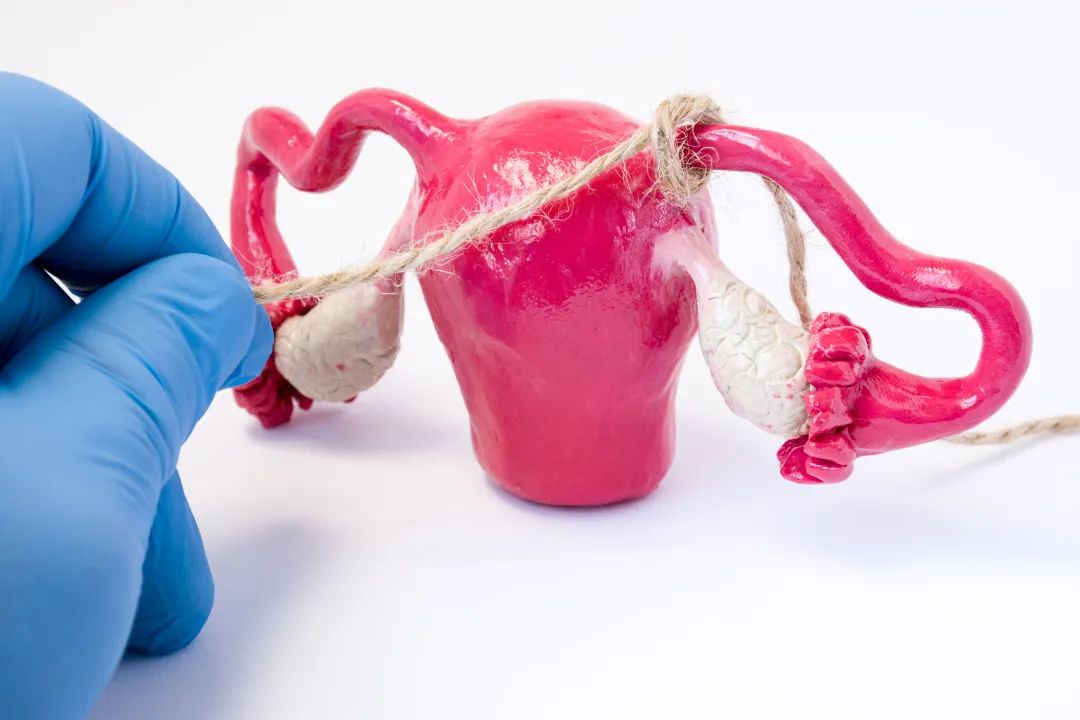 輸卵管阻塞 輸卵管阻塞