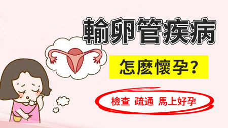 1745224267285570.jpg 輸卵管1.jpg