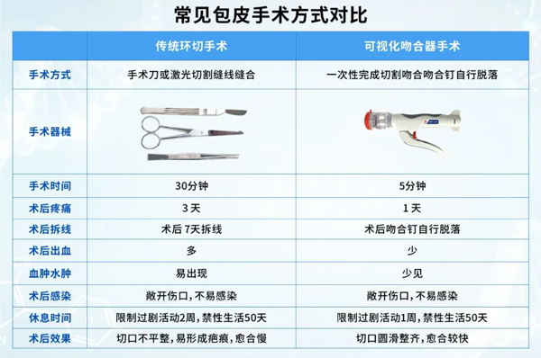 香港男性割包皮怎麼收費?常見手術方式與費用範圍